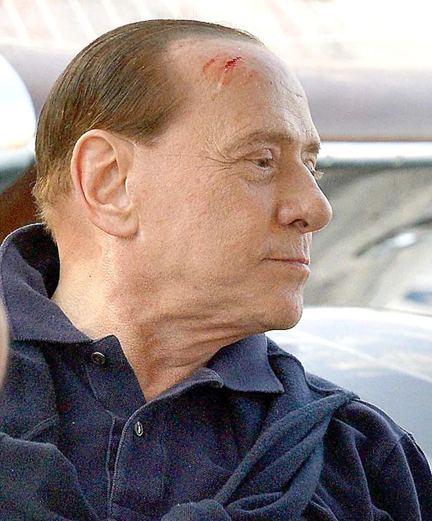 Fostul premier şi-a făcut o ditamai gaura în frunte în urma loviturii