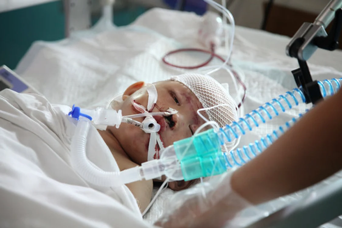 Yue Yue, fetiţa rănită, se află în moarte cerebrală