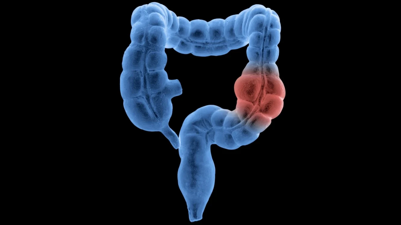 Numărul total de cazuri de cancer a scăzut constant în ultimele decenii. Foto: Arhivă