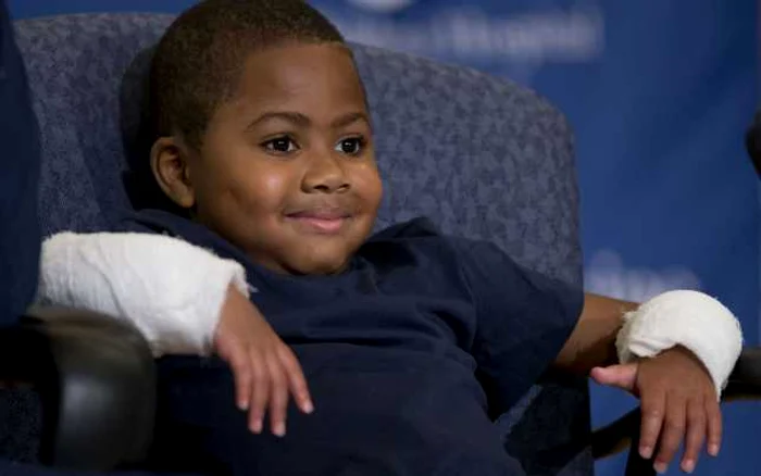 Zion Harvey, cel mai tânăr beneficiar al unui dublu transplant de mâini / Foto AP
