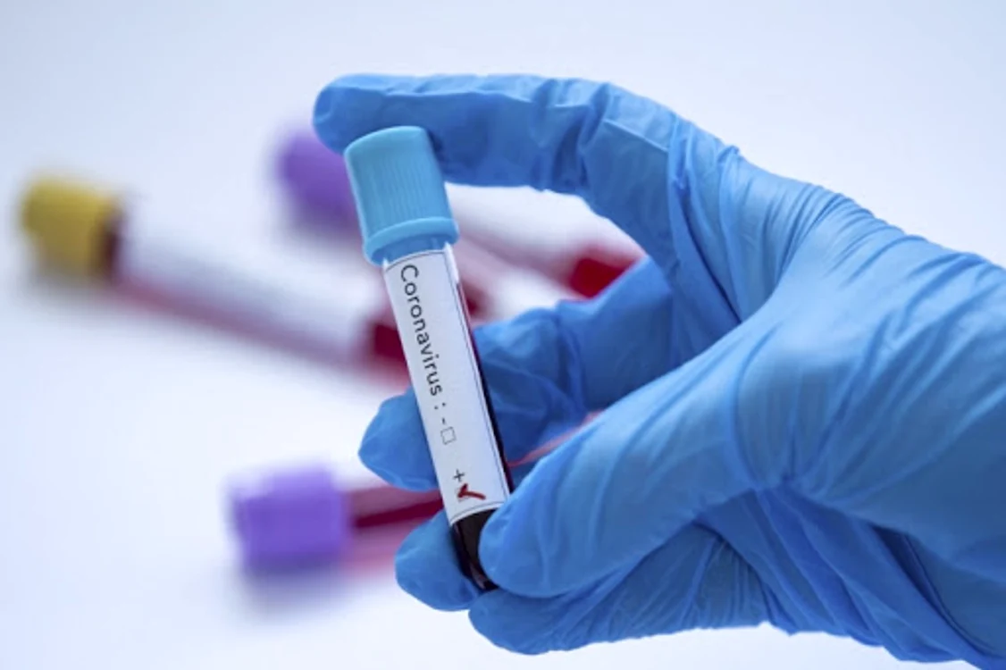 
    Miercuri seară a fost confirmat primul caz de coronavirus din România, în comuna Prigoria, județul GorjFoto: AFP  