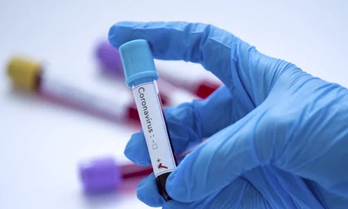 coronavirus 2 jpeg