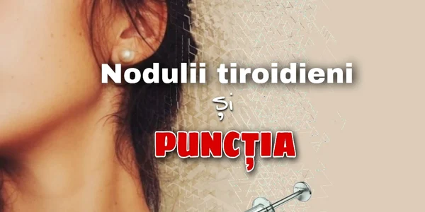 punctie tiroida - foto fb dr ruxandra dobrescu