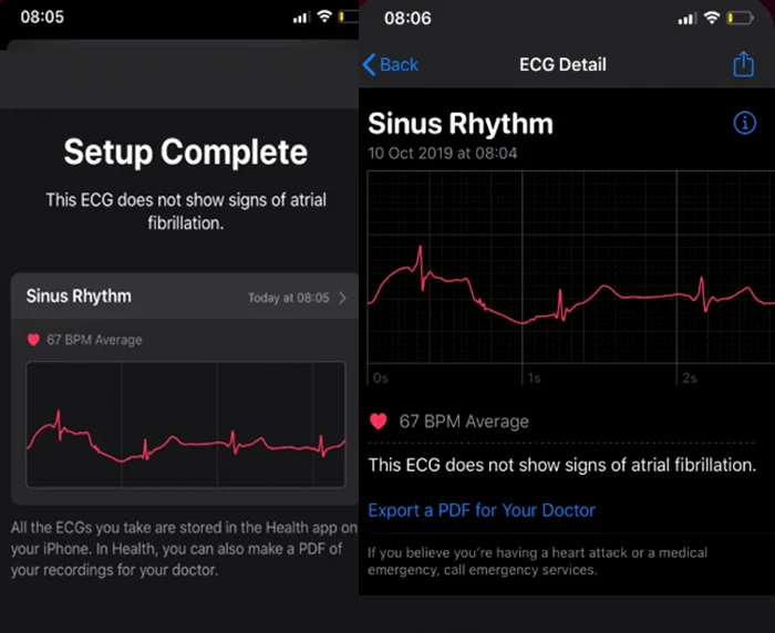 Apple Watch seria 5 ekg ecg