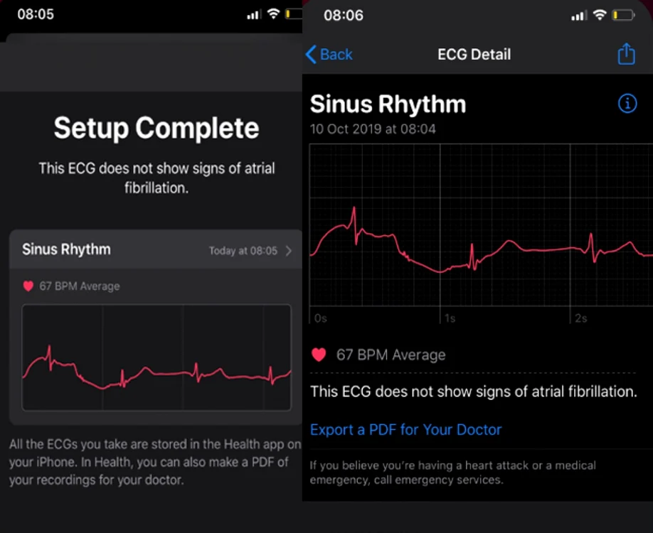 Apple Watch seria 5 ekg ecg