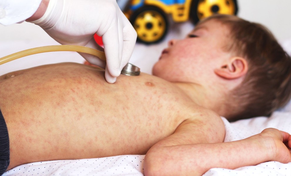 Avertismentul unui pediatru: „Vor veni înapoi maladii care omorau frecvent copiii în trecut“