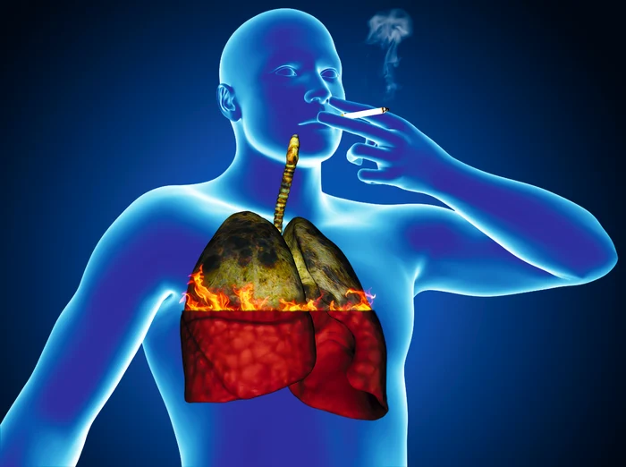 
    Cel mai frecvent tip de cancer din țara noastră este cel pulmonar  