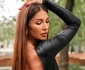 Ilinca Vandici are un spate mai relaxat după tratament foto: Instagram