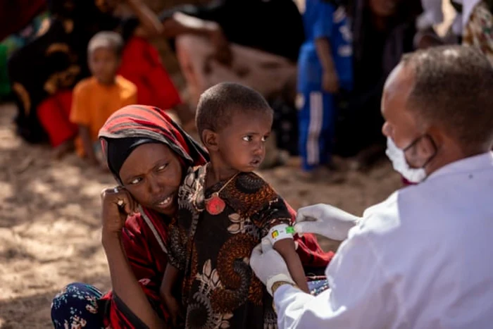 Un lucrător medical măsoară circumferinţa braţului unei fetiţe din Etiopia FOTO UNICEF/Mulugeta Ayene