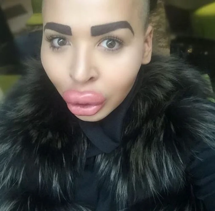 
    Jordan James Parke nu a ezitat să treacă prin intervenții chirurgicale serioase pentru a o copia pe Kim KardashianFoto: arhivă personală  