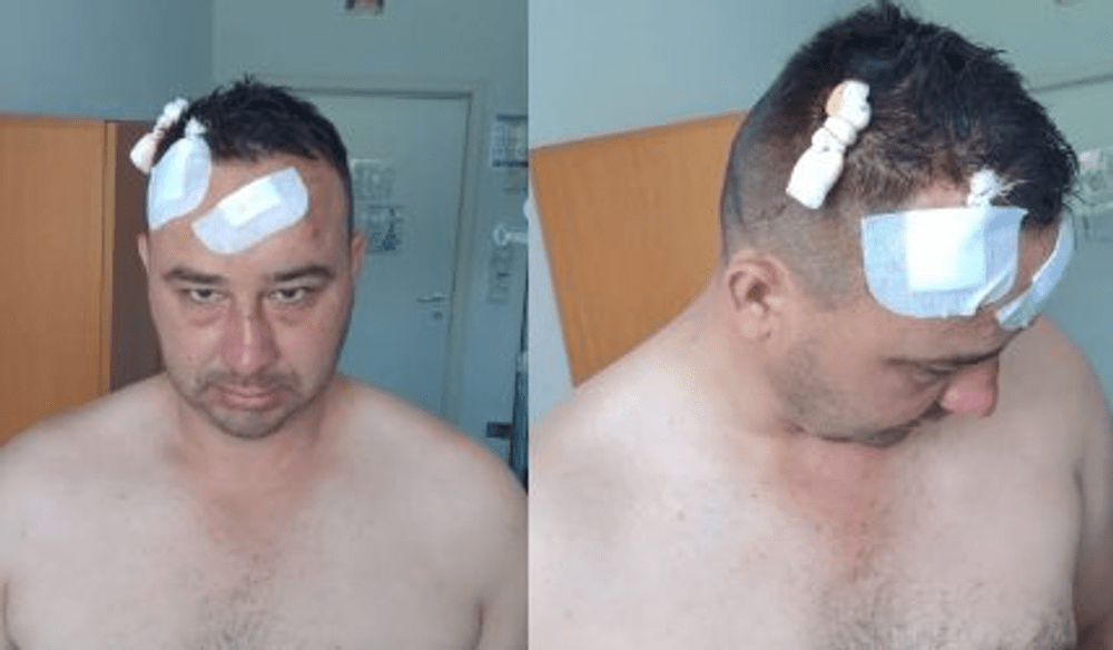 Pădurar bătut de hoții de lemne. L-au dat jos din mașină și l-au lovit cu pietre și bâte 