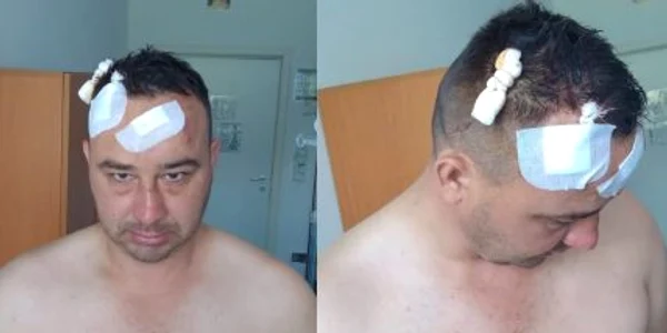 padurar batut FOTO ziaruldebacau ro jpg