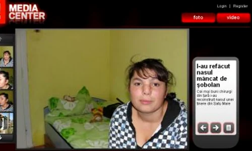 Galerie foto   Operaţie jpeg