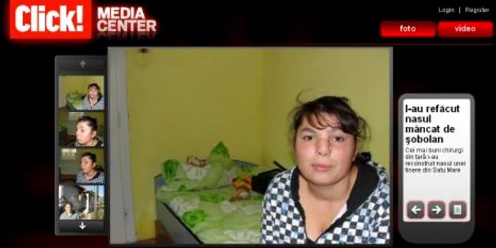 Galerie foto - Operaţie