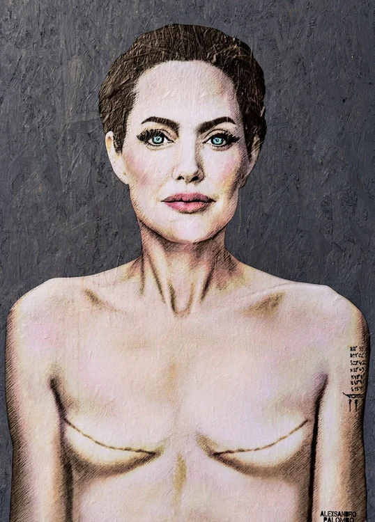 Imagine socanta cu Angelina Jolie si semnele mastectomiei Profimedia (1) jpg