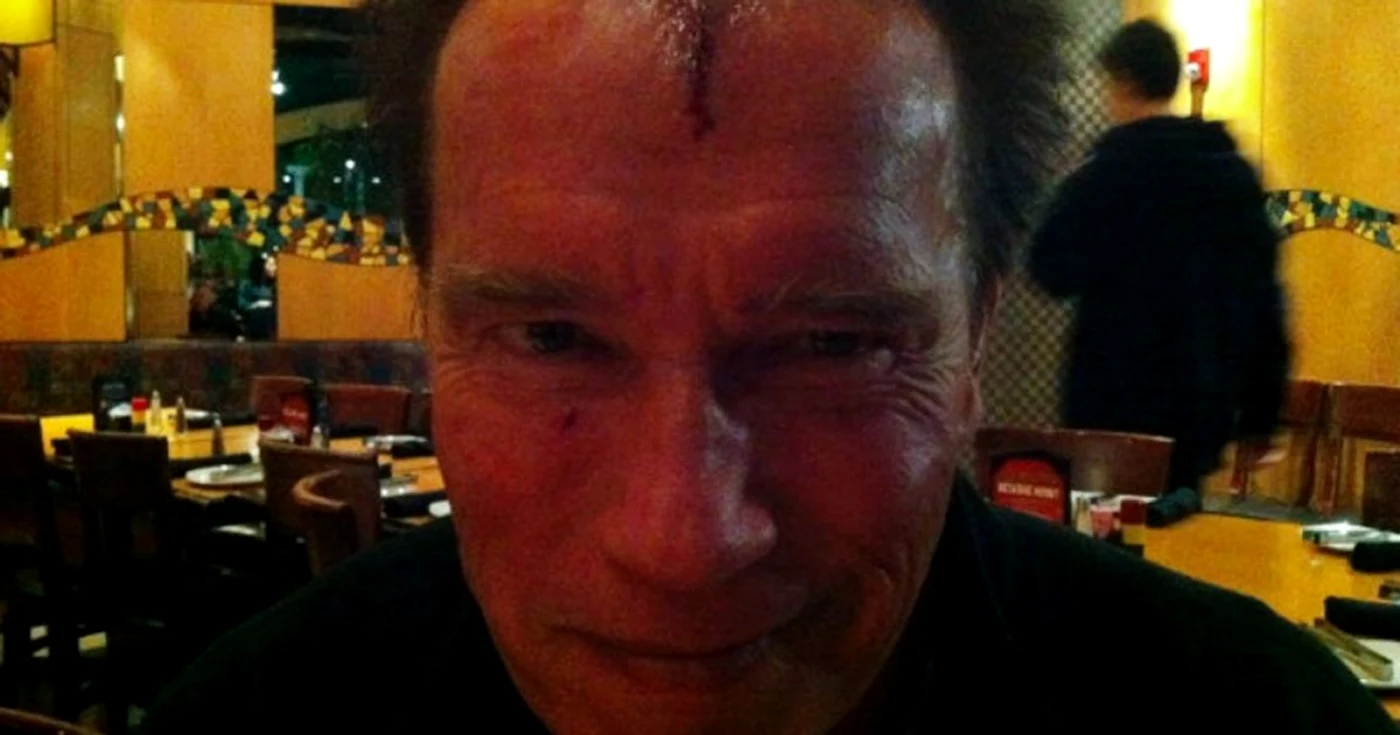 Arnold Schwarzenegger, accidentat