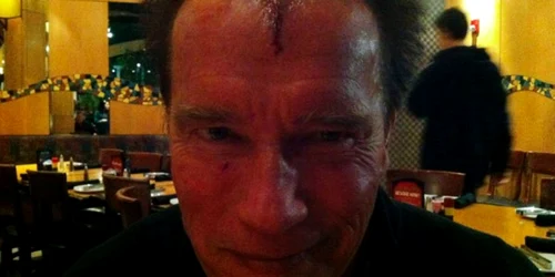 Arnold Schwarzenegger, accidentat