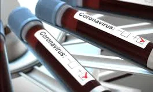 1 coronavirus test jpg jpeg