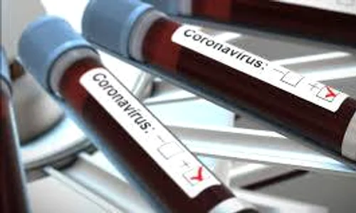 1 coronavirus test jpg jpeg