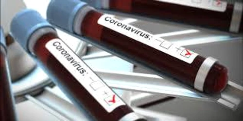 1 coronavirus test jpg jpeg