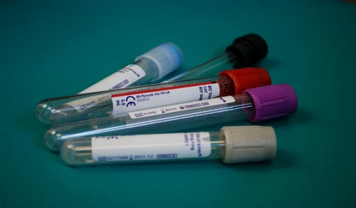 1 75942 original jpg jpeg