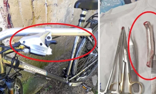 frana bicicleta jpg