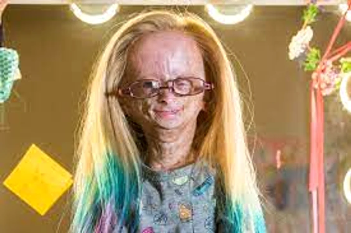 Adalia Rose Williams Sursă foto: Arhivă personală