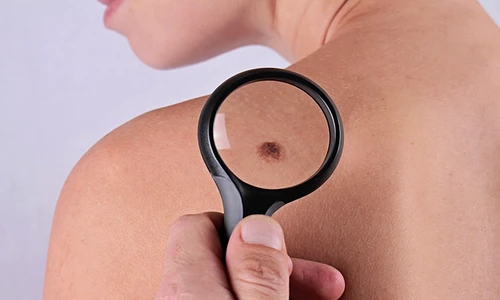 1 76275 original jpg jpeg