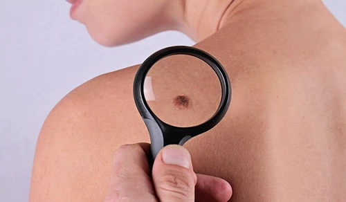 1 76275 original jpg jpeg