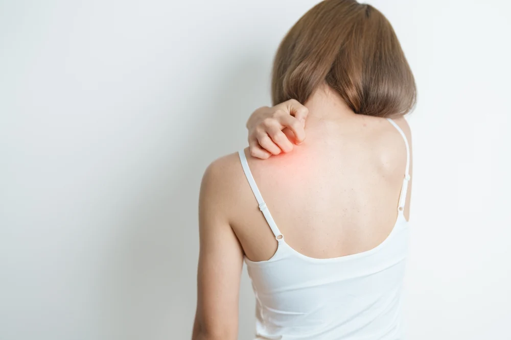 A fost confirmat al doilea caz de lepră în România