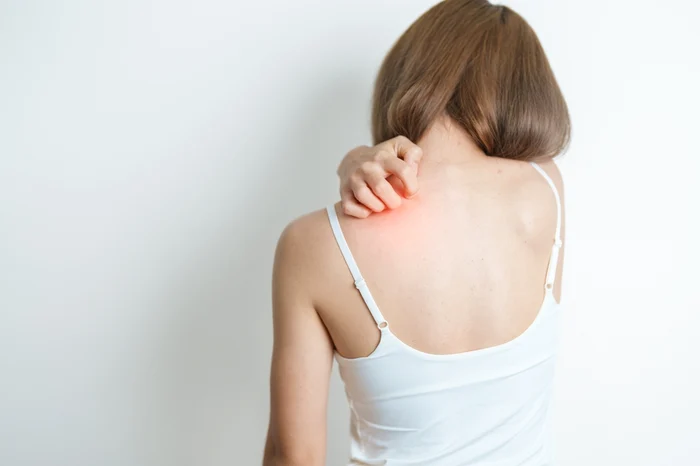 A fost confirmat un caz de lepră, iar alte trei suspiciuni sunt în analiză/FOTO: Shutterstock