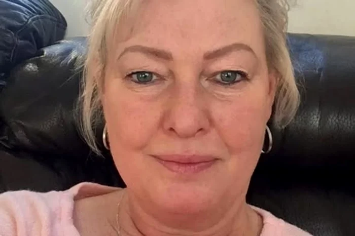 O femeie a murit din cauza rabiei la patru luni după ce a fost zgâriată de un câine fără stăpân.