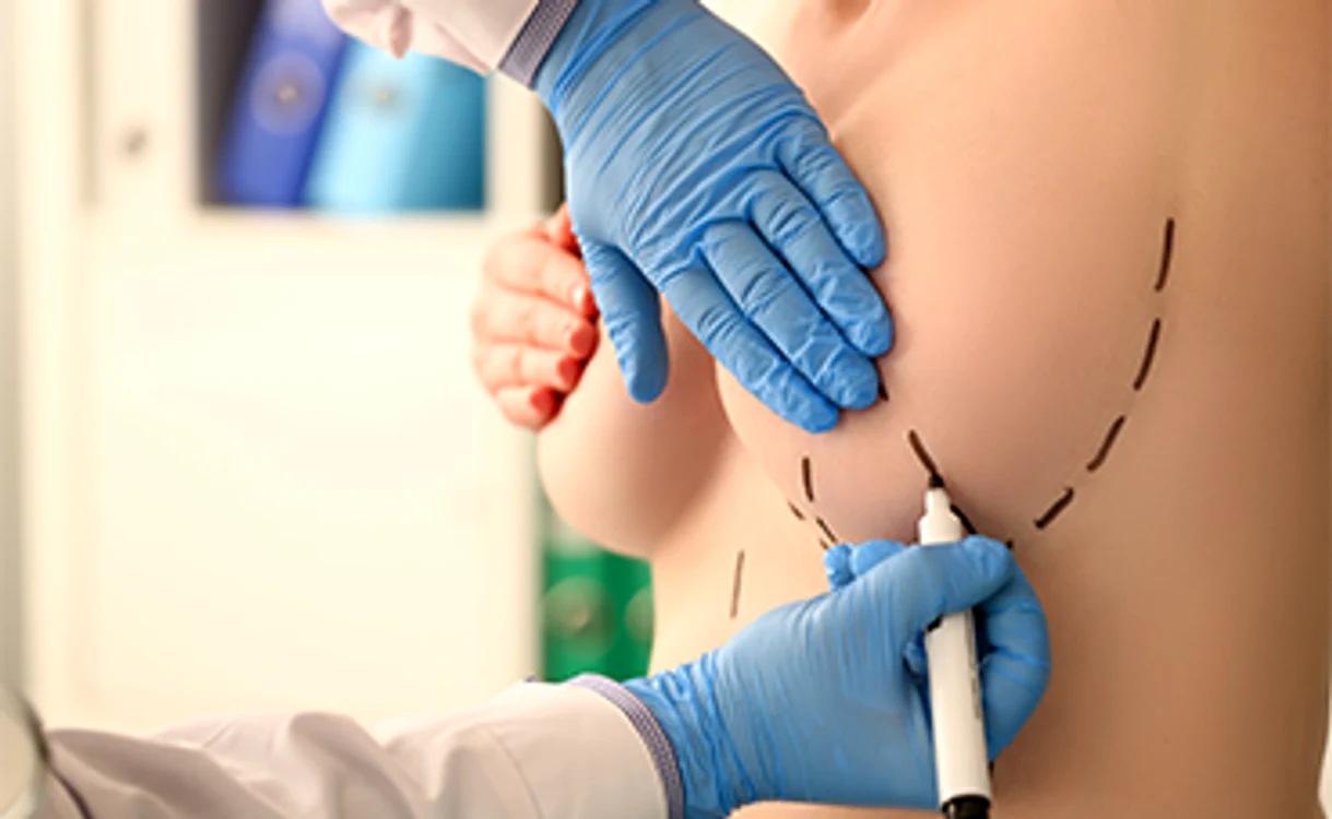
    Medicul din Dusseldorf, expert în chirurgia sânilor  