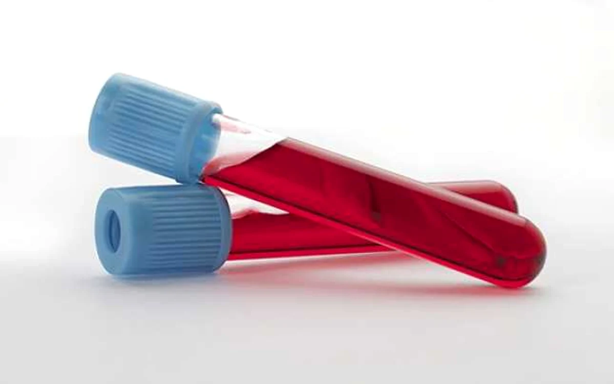 Un test rapid de sânge poate spune dacă o infecţie e produsă de un virus sau de o bacterie FOTO bbc.com