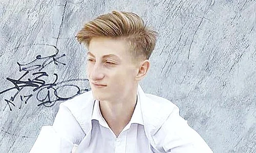 Alexandru a suferit arsuri  de gradul 2 şi 3  pe jumătate din  corp  A trecut  prin cinci operaţii,  dar are nevoie  de bani pentru  recuperare   jpeg
