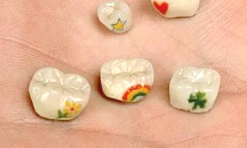 Tatuajele  pe dinţi  sunt în  mare vogă jpeg