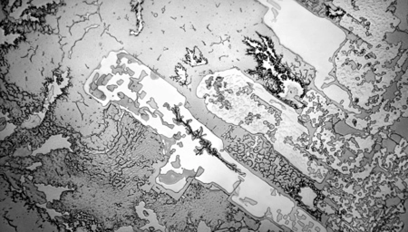 Aşa arată o lacrimă sub microscop