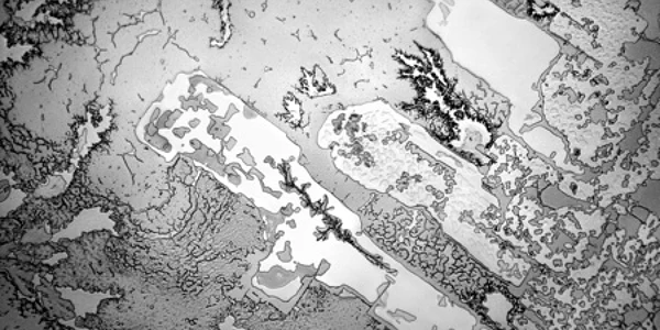 lacrimi microscop