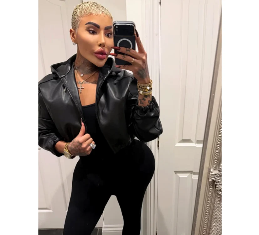 Influencerul Jordan James Parke ar fi murit după o procedură cosmetică. FOTO: Instagram 