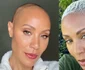 Jada Pinkett Smith suferă de alopecie