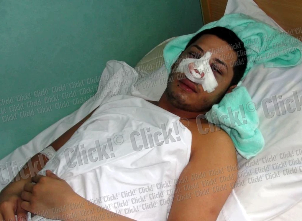 Adrian Pescariu încearcă să se recupereze după accident.