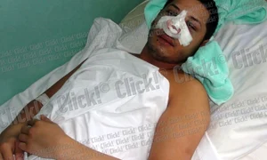 Adrian Pescariu încearcă să se recupereze după accident  jpeg