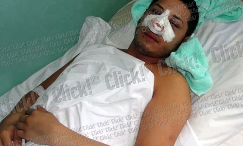 Adrian Pescariu încearcă să se recupereze după accident  jpeg