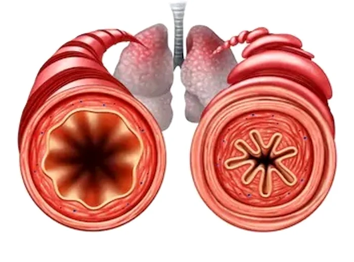 2 astm grafic jpg jpeg