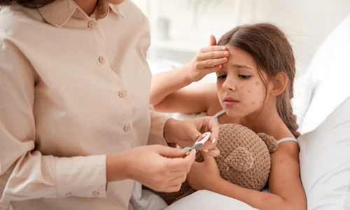Tot ce trebuie sa stii despre scarlatina, varicela si rujeola de la primele simptome  Sursa foto shutterstock 2121636500 jpg