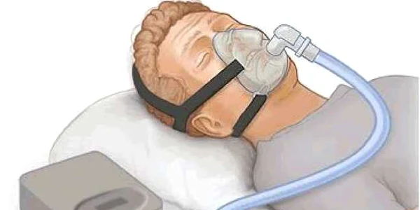 cpap pentru sforait 