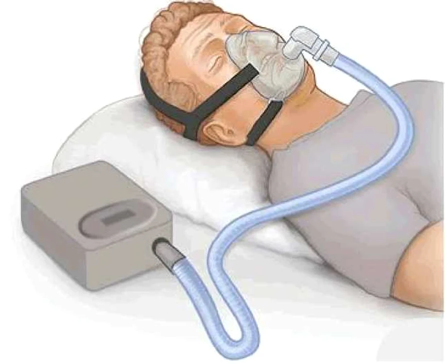 cpap pentru sforait 