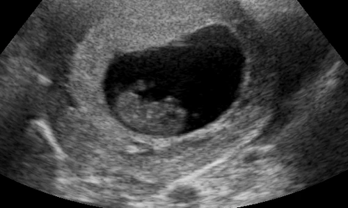 1 67377 original jpg jpeg