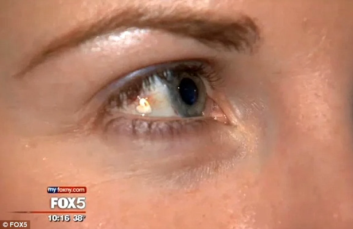 foto FOX5
