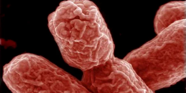 E. coli FOTO AFP